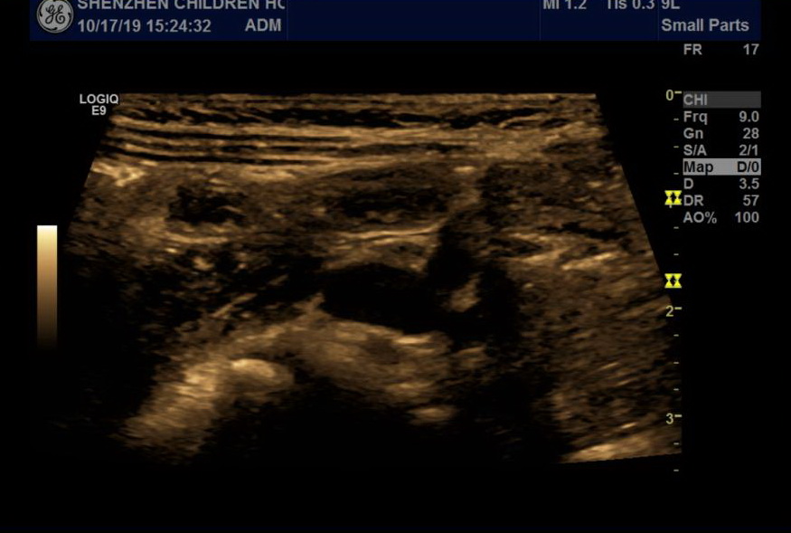 W020201028725741714610.jpg