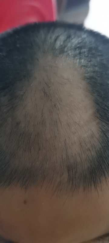 W020201028729756735076.jpg