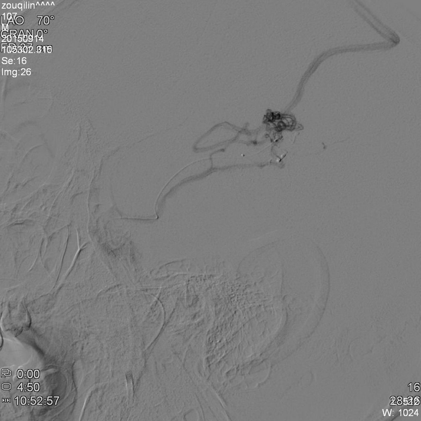 W020201028705569639744.jpg