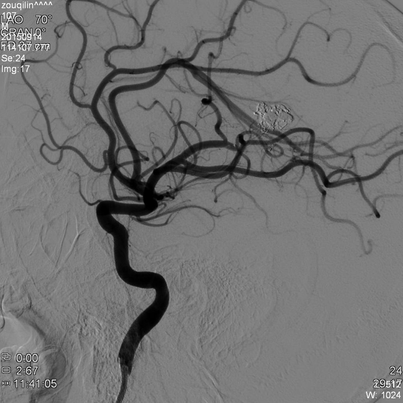W020201028705569691359.jpg